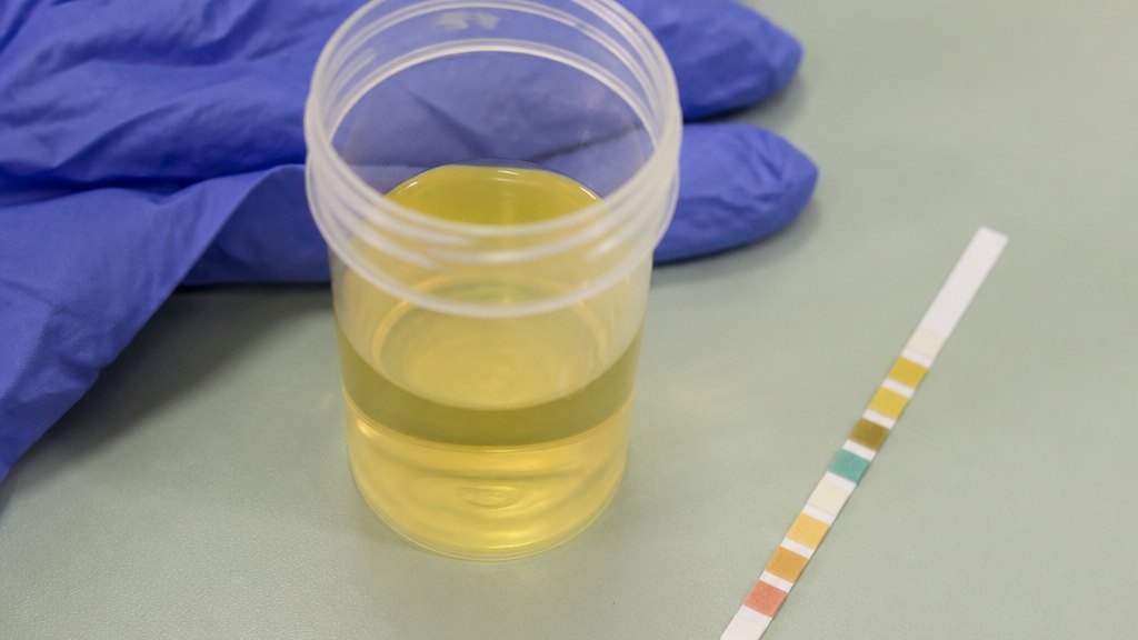 Three days into a course the sample runs clean. That is the whole job the prescription was designed to do, and it is a job about the urine.