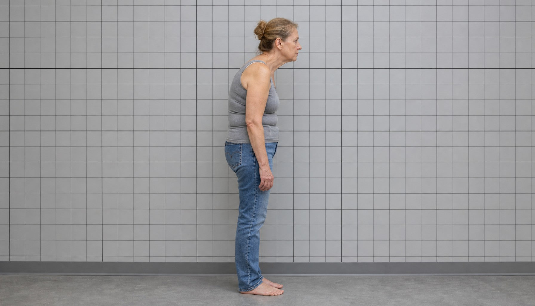 Patient side profile showing upper-back curvature on intake