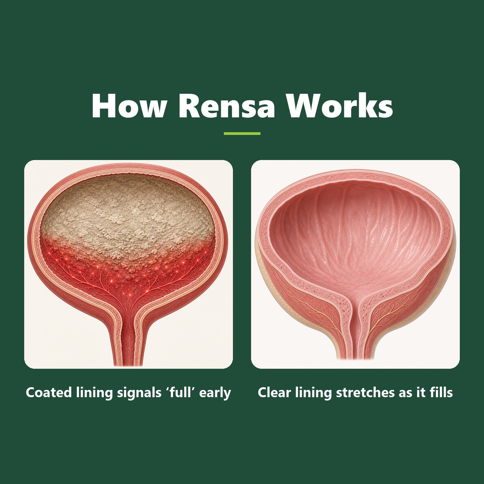 Rensa Bladder Sediment Complex — Launch Offer image 6